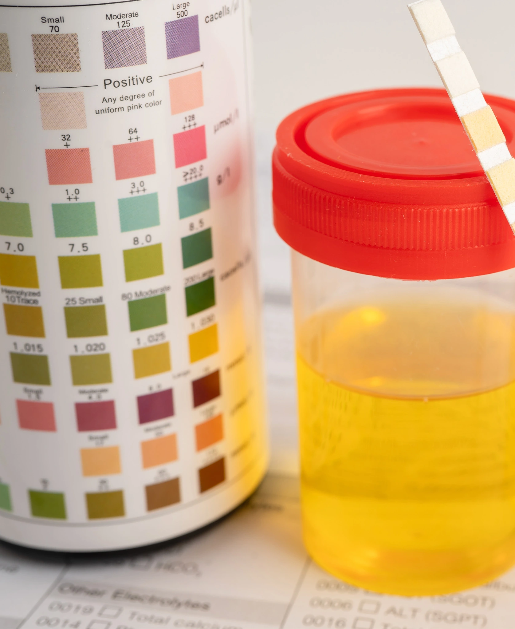 Urine Test